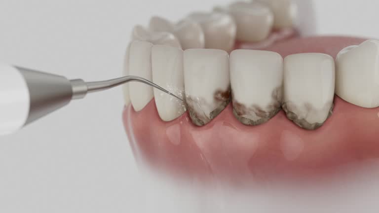 Reliable Dental contractor in Virginia, IL by Smile Center Dentistry